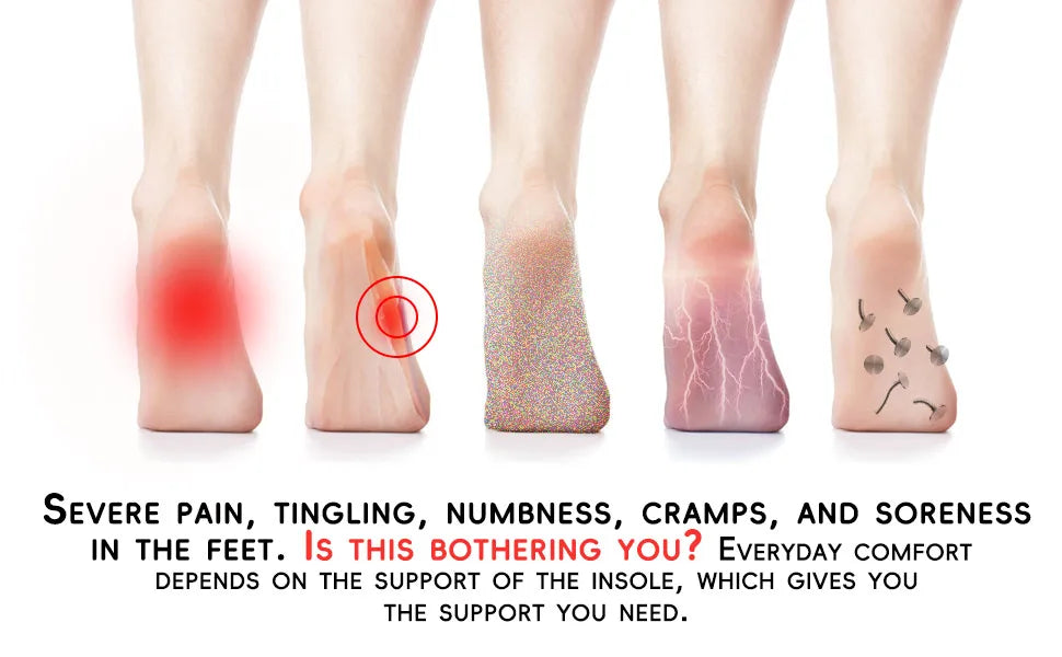 1Pair Acupressure Magnetic Therapy Insoles Slimming Breathable Running Shoes Cushion Feet Health Care Arch Support Sport Insoles